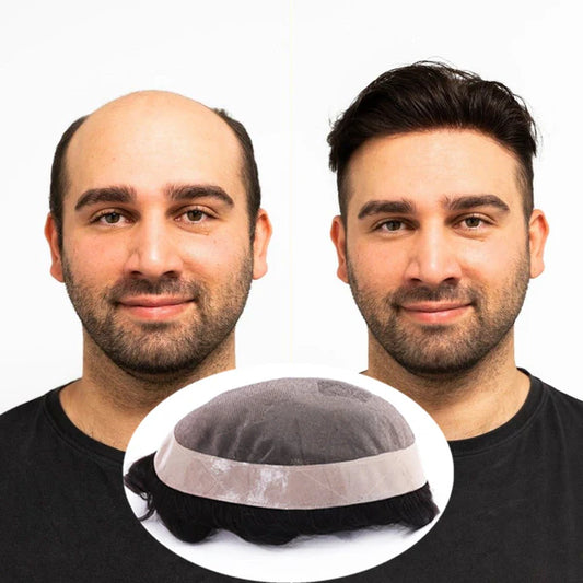 Classic (Fine Mono with Thin Skin Perimeter Hairpiece for Men)