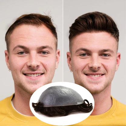 SuperSkin-V (Premium Antimicrobial Hair Systems for Long Lasting Comfort)