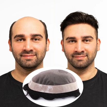 Royal (Fine Mono with PU Perimeter and Folded Lace Front Stock Hair System for Men)